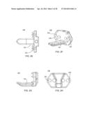 Implantation Tools for Interspinous Process Spacing Device diagram and image