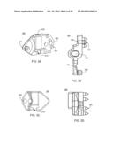 Implantation Tools for Interspinous Process Spacing Device diagram and image