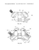 Implantation Tools for Interspinous Process Spacing Device diagram and image