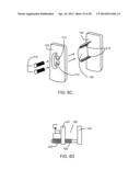 Implantation Tools for Interspinous Process Spacing Device diagram and image