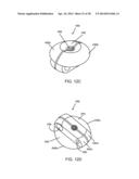 Implantation Tools for Interspinous Process Spacing Device diagram and image