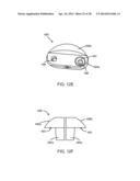 Implantation Tools for Interspinous Process Spacing Device diagram and image