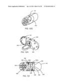 Implantation Tools for Interspinous Process Spacing Device diagram and image