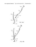 Implantation Tools for Interspinous Process Spacing Device diagram and image