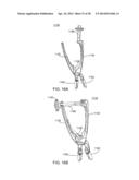 Implantation Tools for Interspinous Process Spacing Device diagram and image