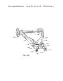 Implantation Tools for Interspinous Process Spacing Device diagram and image