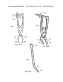 Implantation Tools for Interspinous Process Spacing Device diagram and image