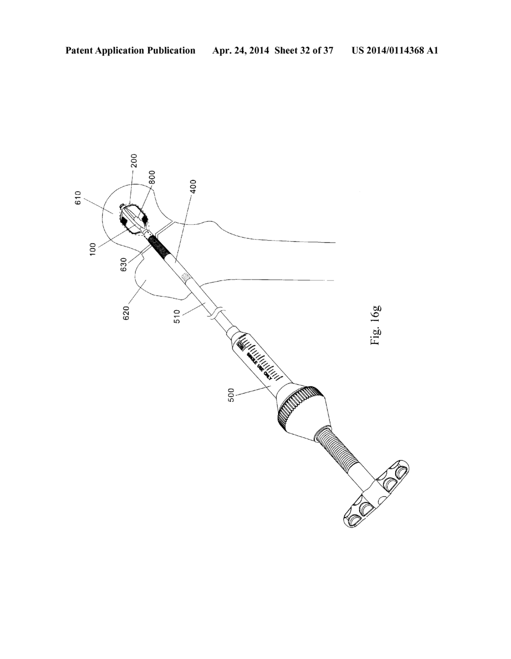 DEVICE FOR BONE FIXATION - diagram, schematic, and image 33