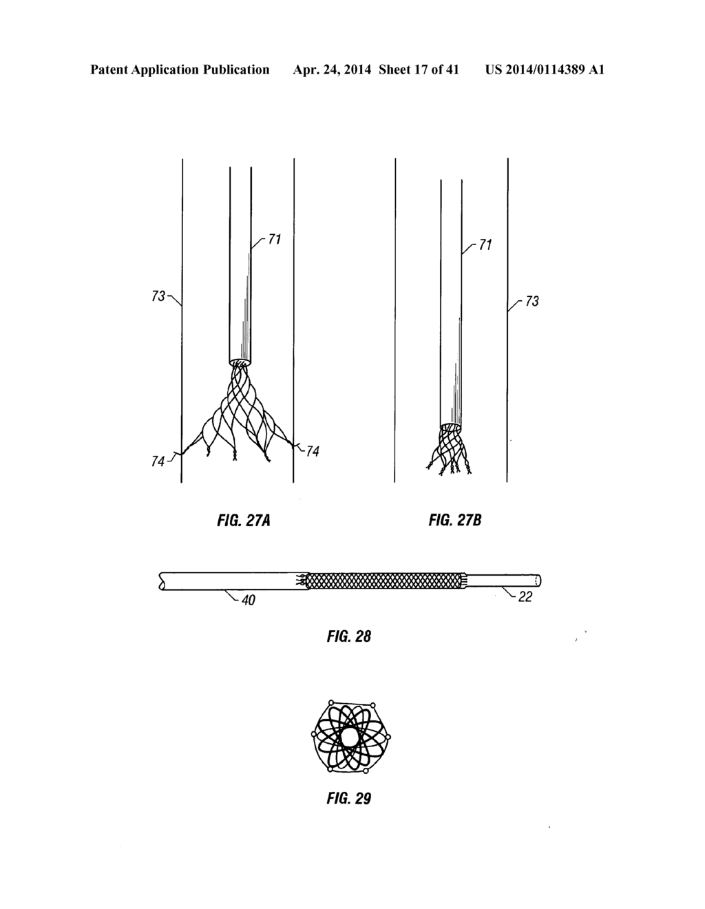 PLAIN WOVEN STENTS - diagram, schematic, and image 18