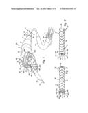 METHOD AND APPARATUS FOR CONTROLLING THE DEPLOYMENT OF A STENT diagram and image