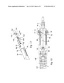 METHOD AND APPARATUS FOR CONTROLLING THE DEPLOYMENT OF A STENT diagram and image