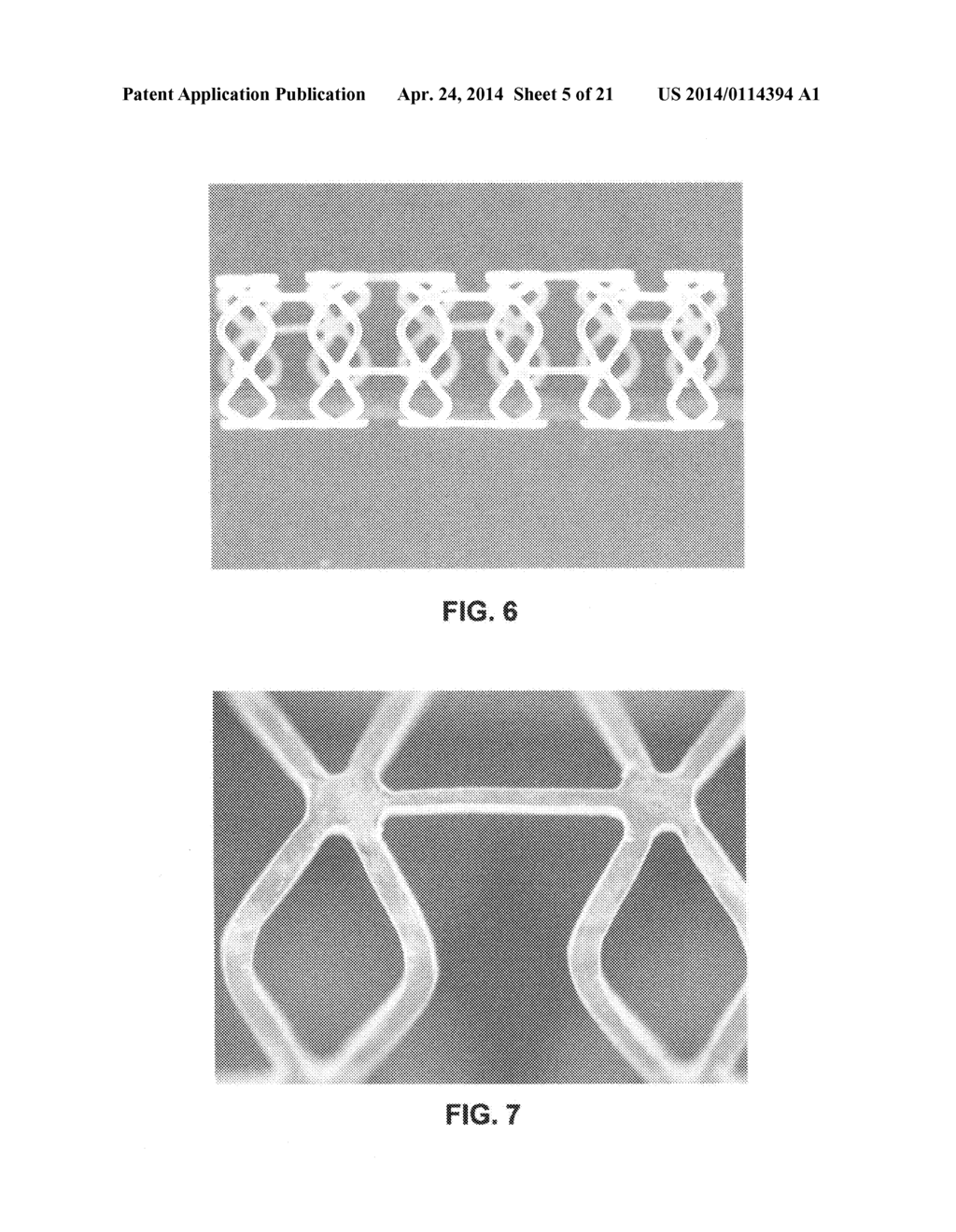 Biodegradable stent with enhanced fracture toughness - diagram, schematic, and image 06