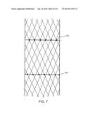 Percutaneously Implantable Replacement Heart Valve Device and Method of     Making Same diagram and image