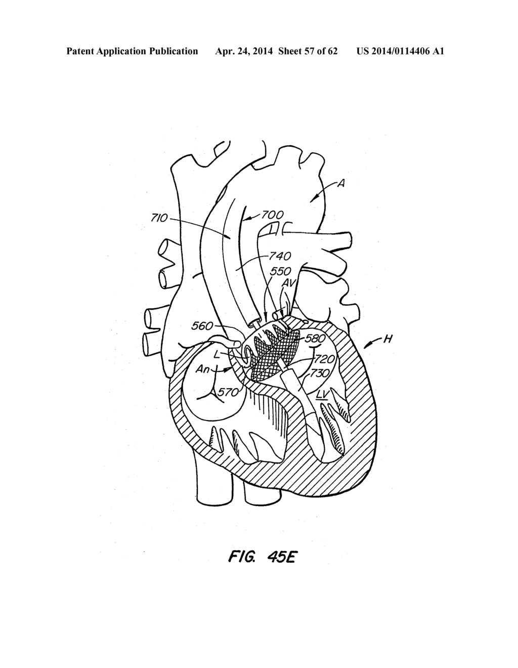 LOW PROFILE HEART VALVE AND DELIVERY SYSTEM - diagram, schematic, and image 58