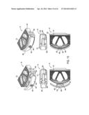 EXPANDABLE INTER-BODY FUSION DEVICES AND METHODS diagram and image