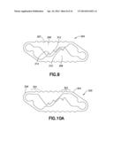 PLASTICALLY DEFORMABLE INTER-OSSEOUS DEVICE diagram and image