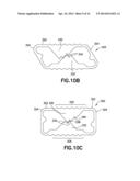 PLASTICALLY DEFORMABLE INTER-OSSEOUS DEVICE diagram and image