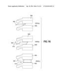 PLASTICALLY DEFORMABLE INTER-OSSEOUS DEVICE diagram and image