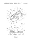 IMPLANT diagram and image