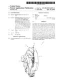 HAND PROSTHESIS diagram and image