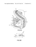 GOGGLE WITH ADJUSTABLE NOSE AREA diagram and image