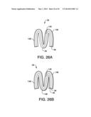 METHOD OF MANUFACTURING TAMPONS BY FORMING A SOFTWIND WITH CONTACT     ELEMENTS diagram and image