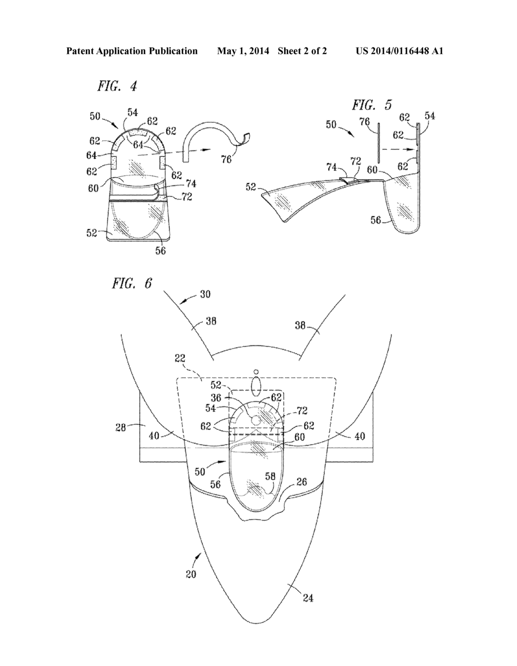 Laboring patient dignity poo pouch - diagram, schematic, and image 03