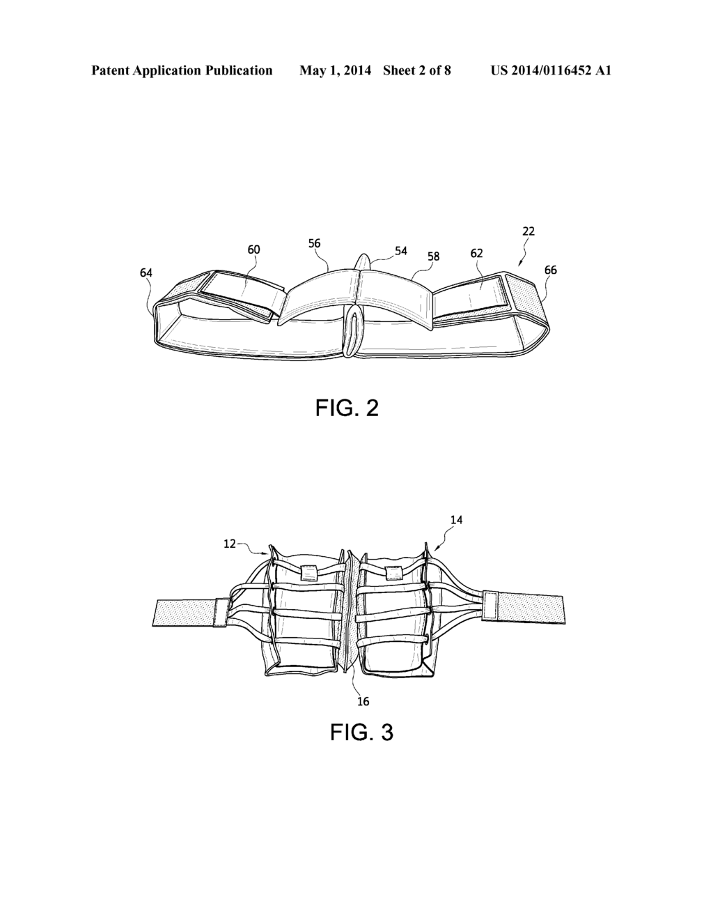 MOTION RESTRICTION KIT - diagram, schematic, and image 03