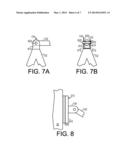 Stationary Boom Support System diagram and image