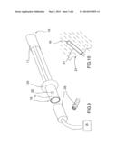 EXPANDABLE MINE BOLT diagram and image