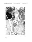 PROTECTION FROM LETHAL IRRADIATION WITH MESENCHYMAL STROMAL CELLS diagram and image