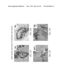 THERAPEUTIC AND DIAGNOSTIC METHODS RELATED TO LYSYL OXIDASE-LIKE 2 (LOXL2) diagram and image