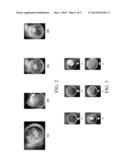 Dissolvable Strip for Treatment of Oral Thermal Burns diagram and image