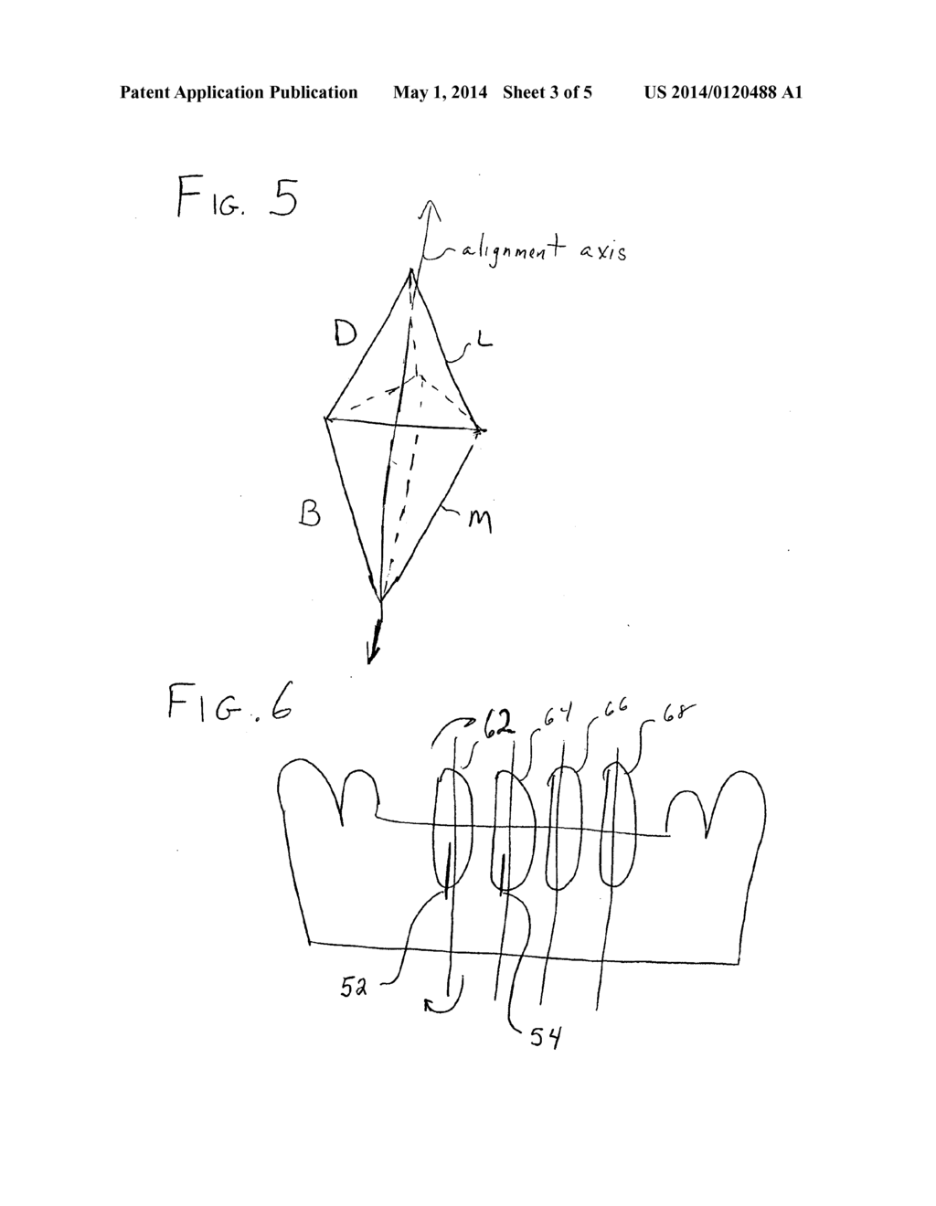 Orthodontic Treatment Aligners Based on CT Data - diagram, schematic, and image 04