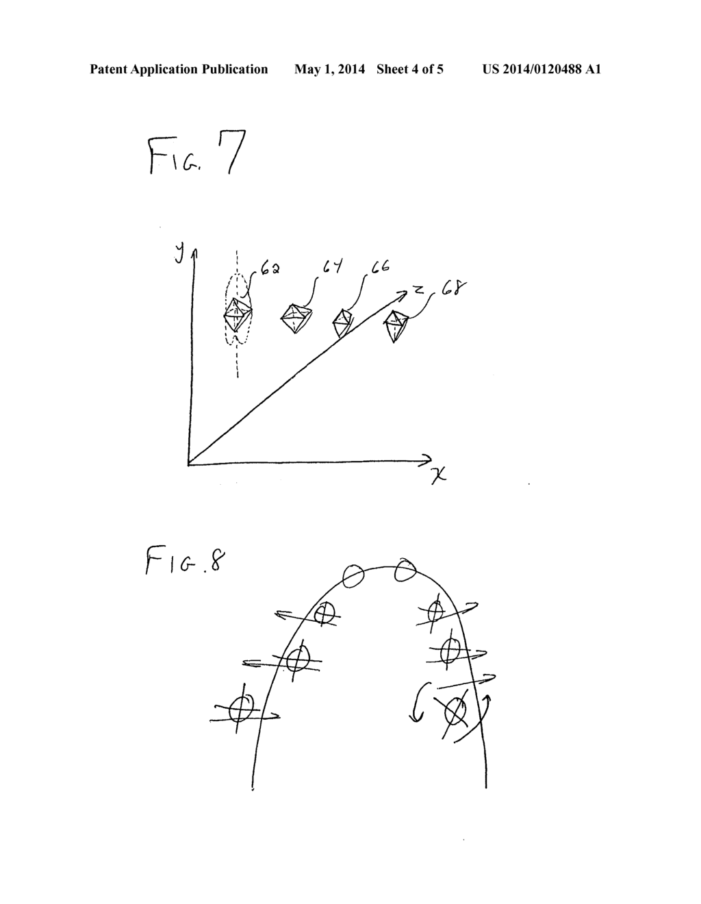 Orthodontic Treatment Aligners Based on CT Data - diagram, schematic, and image 05