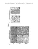 METHODS OF DETECTING AXL AND GAS6 IN CANCER PATIENTS diagram and image