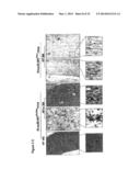 MATERIALS AND METHODS FOR SUPPRESSING AND/OR TREATING NEUROFIBROMA AND     RELATED TUMORS diagram and image