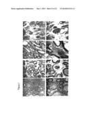 MATERIALS AND METHODS FOR SUPPRESSING AND/OR TREATING NEUROFIBROMA AND     RELATED TUMORS diagram and image