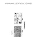 MATERIALS AND METHODS FOR SUPPRESSING AND/OR TREATING NEUROFIBROMA AND     RELATED TUMORS diagram and image