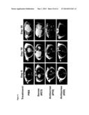 C-MYC ANTISENSE OLIGONUCLEOTIDES AND METHODS FOR USING THE SAME TO TREAT     CELL-PROLIFERATIVE DISORDERS diagram and image