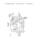 Magnetic Abutment Systems, Devices, Components and Methods for Bone     Conduction Hearing Aids diagram and image