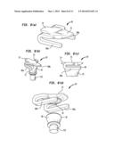 Abutment Attachment Systems, Mechanisms, Devices, Components and Methods     for Bone Conduction Hearing Aids diagram and image