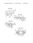 Abutment Attachment Systems, Mechanisms, Devices, Components and Methods     for Bone Conduction Hearing Aids diagram and image