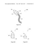 SYSTEMS, METHODS AND DEVICES RELATING TO IMPLANTABLE SUPPORTIVE SLINGS diagram and image