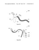 SYSTEMS, METHODS AND DEVICES RELATING TO IMPLANTABLE SUPPORTIVE SLINGS diagram and image