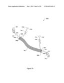 SYSTEMS, METHODS AND DEVICES RELATING TO IMPLANTABLE SUPPORTIVE SLINGS diagram and image