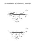 SYSTEMS, METHODS AND DEVICES RELATING TO IMPLANTABLE SUPPORTIVE SLINGS diagram and image