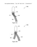 SYSTEMS, METHODS AND DEVICES RELATING TO IMPLANTABLE SUPPORTIVE SLINGS diagram and image