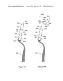 SYSTEMS, METHODS AND DEVICES RELATING TO IMPLANTABLE SUPPORTIVE SLINGS diagram and image