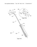 SYSTEMS, METHODS AND DEVICES RELATING TO IMPLANTABLE SUPPORTIVE SLINGS diagram and image